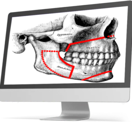 Orthognathic surgery