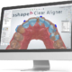 clear aligner 2